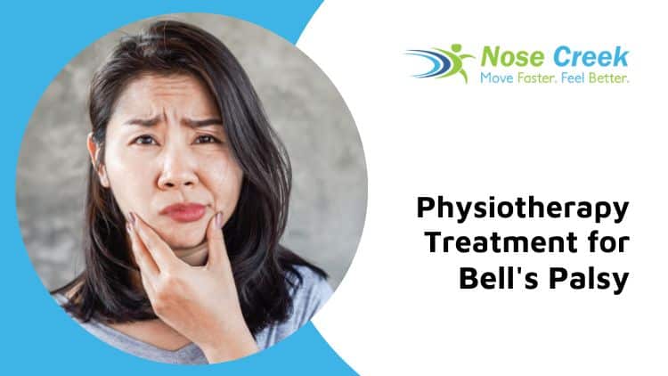 physiotherapy for bell’s palsy calgary